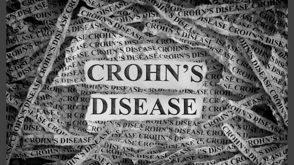 Doença de crohn